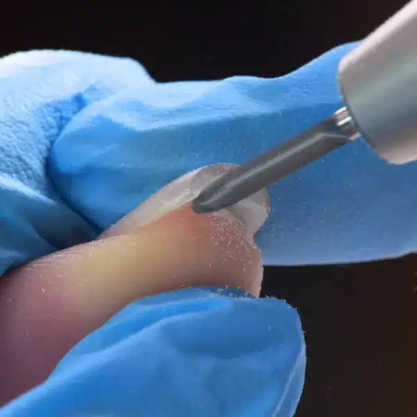 Gel Removal from under the nail